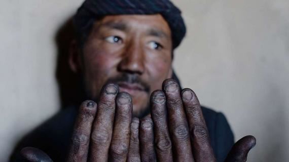 media.news.imagealternatetextformat.details