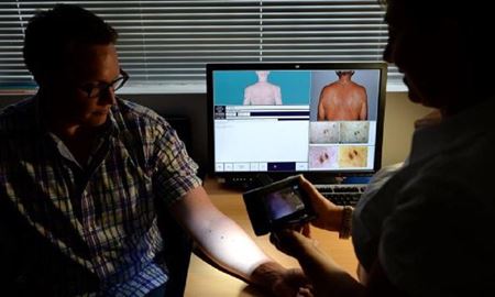 جایگاه نخست استرالیا در ابتلا به سرطان پوست در جهان