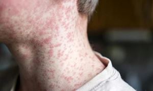 media.news.imagealternatetextformat.details