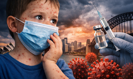 هشدار بهداشتی در سیدنی؛ افزایش موارد سرخک و نگرانی از شیوع گسترده