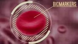 محققان استرالیا... تشخیص درد مزمن با یک آزمایش