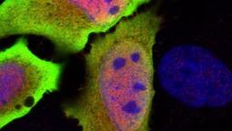 دانشمندان استرالیا ژنی را شناسایی کردند که می تواند به درمان سرطان کمک کند