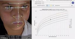 محققان استرالیا/ بیماری‌های نادر کودکان با اسکن 3بعدی چهره تشخیص داده می شود