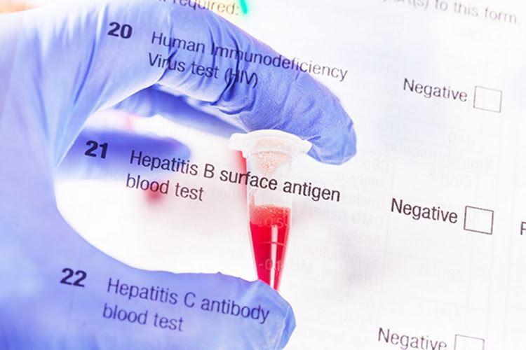 هپاتیت B،کشنده‌تر از مالاریا/کبد بر اثر هپاتیت B آسیب دیده و به نوعی سرطان کشنده منجر می‌شود