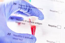 هپاتیت B،کشنده‌تر از مالاریا/کبد بر اثر هپاتیت B آسیب دیده و به نوعی سرطان کشنده منجر می‌شود