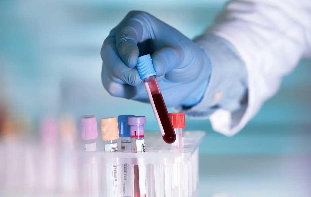 ​گروه خونی چه تأثیری بر احتمال ابتلا به کرونا ویروس دارد؟