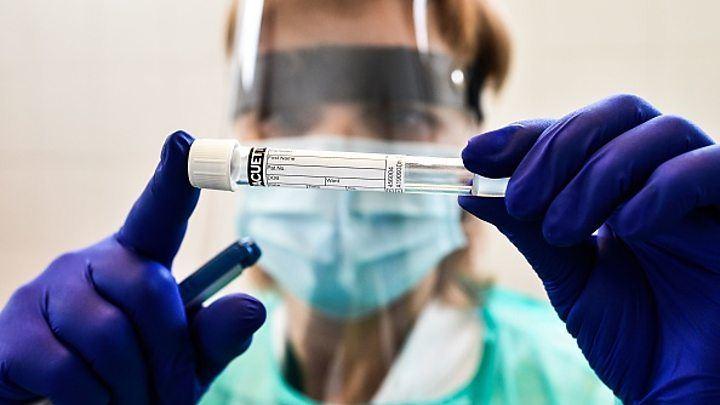 پادتن (آنتی‌بادی) از ابتلا به کرونا تنها چندین ماه پس از بهبودی تاثیر‌ دارد