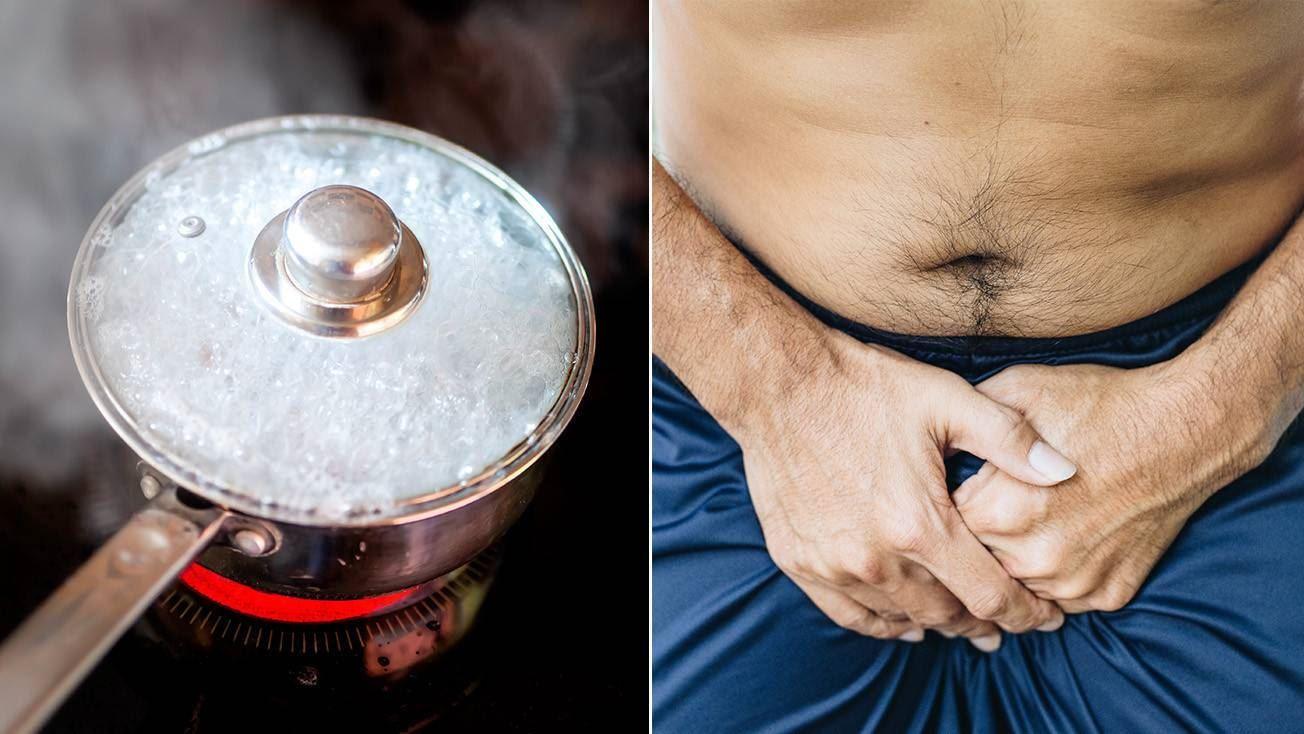 یک زن به جرم ریختن آب جوش روی پایین تنه دوست پسرش ، مجرم شناخته شد