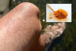 استفاده از زردچوبه برای بهبودی درد آرتروز مفصل زانو 