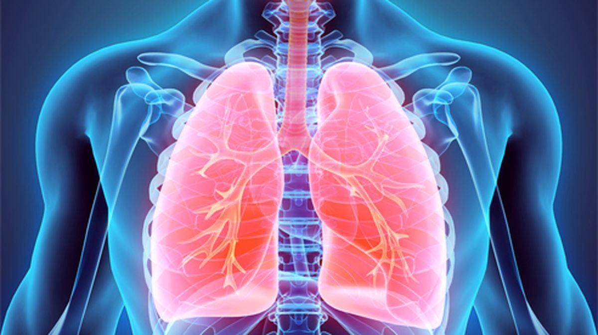 پیوند موفق ریه از اهداکننده زنده به بیمار مبتلا به کووید19