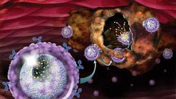 غربالگری سرطان پروستات تا چندسال آینده امکان‌پذیر می‌شود