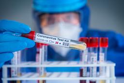 اپیدمیولوژیست استرالیایی: ابتلای چندباره به کووید-۱۹ امکان‌پذیر است