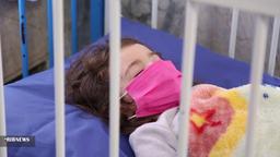 تاثیر امیکرون بر افزایش موارد بستری کودکان مبتلا به کرونا