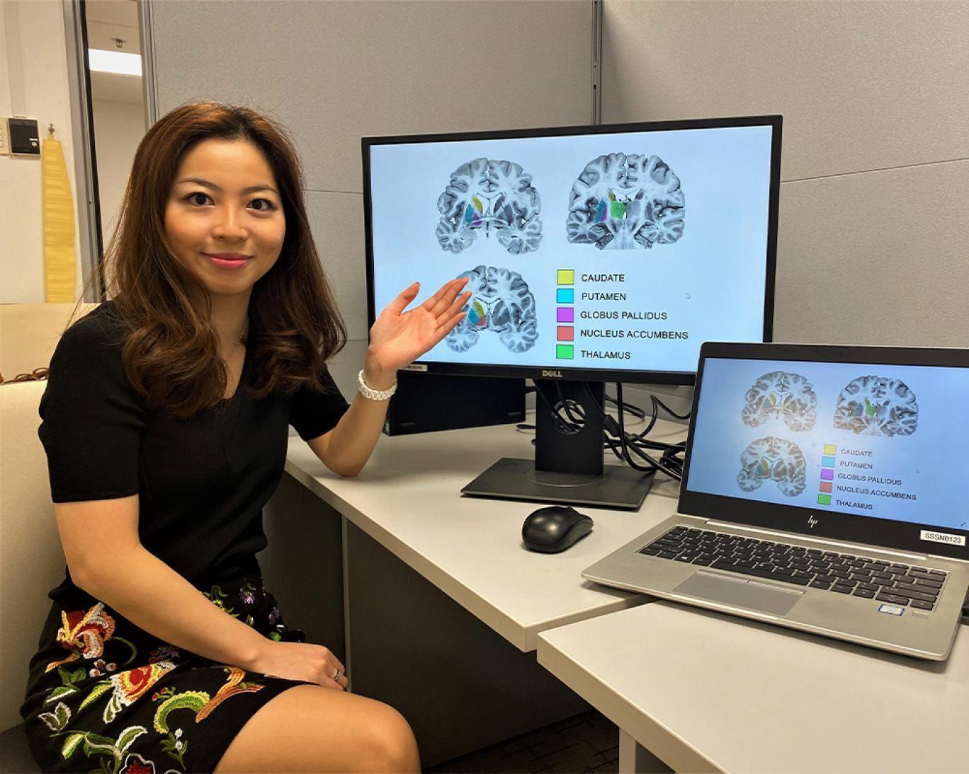 قسمت قدامی مغز تبهکاران روانی 10 درصد بزرگتر از افراد معمولی است