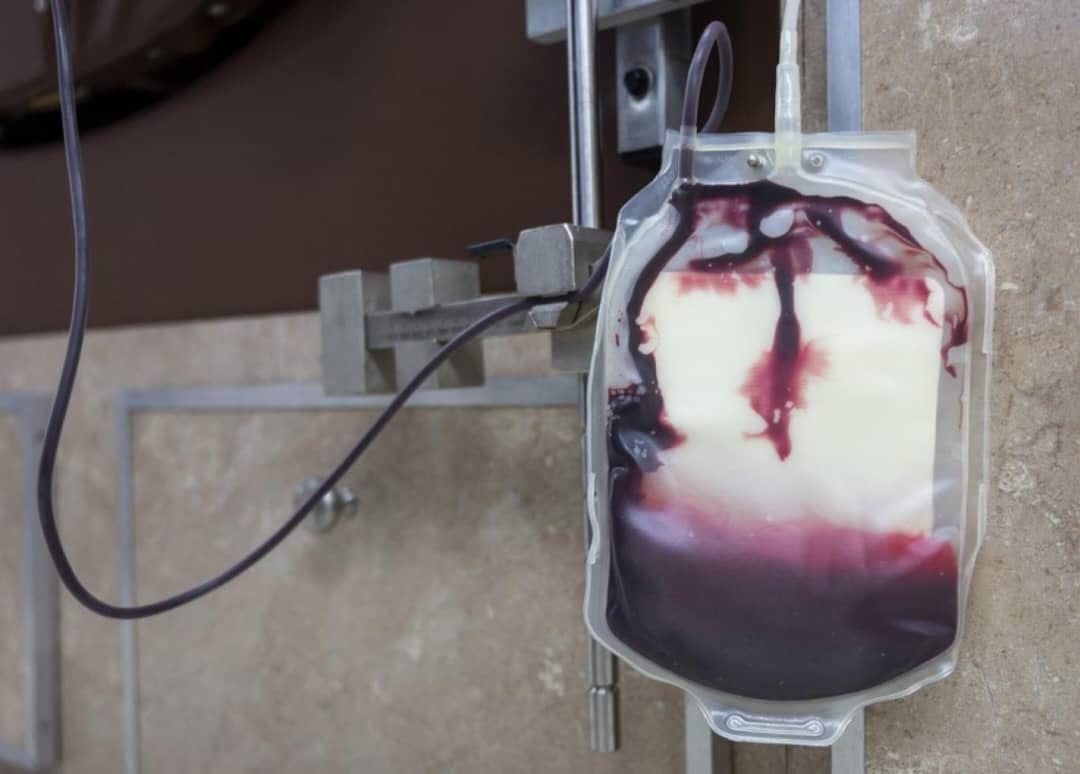 پرداخت غرامت به دلیل استفاده از خون‌های آلوده پس از چند دهه