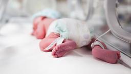 خطر تولد نوزادان مبتلا به ناهنجاری در ایران با تصمیم دولت