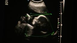 سقط جنین در استرالیای غربی دیگر جرم محسوب نمی‌شود