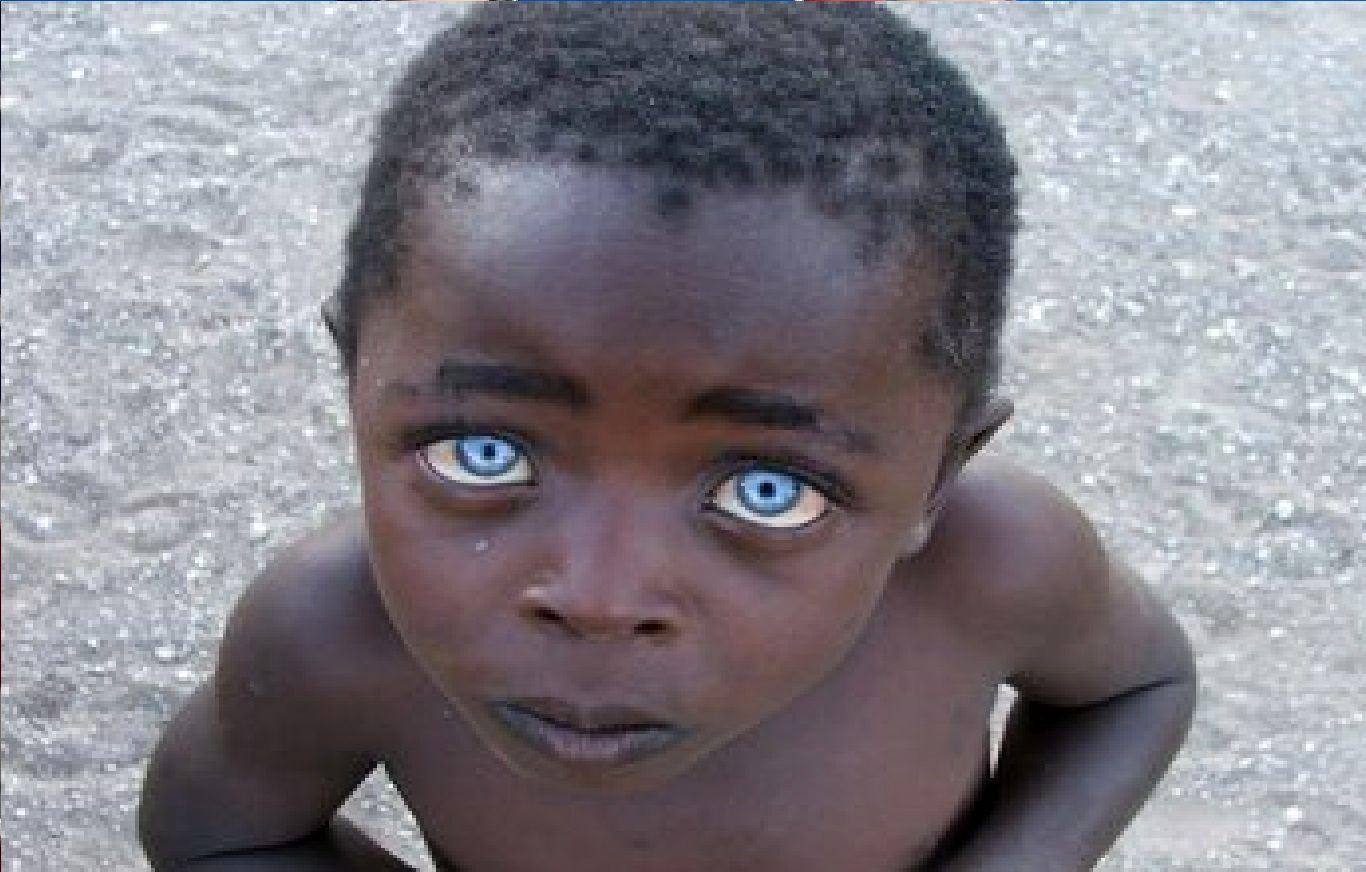 کمیاب‌ترین رنگ چشم در میان انسان‌ها کدام است؟