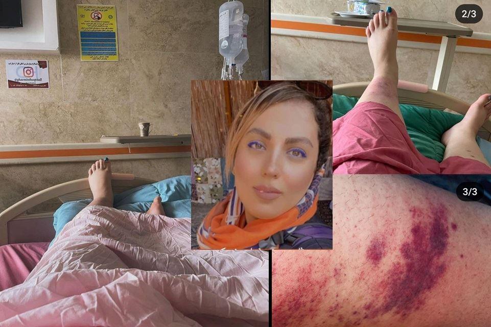 مرگ سارا دلدار ، زندانی سیاسی سابق، بر اثر عفونت‌های ناشی از جراحات ساچمه‌ای