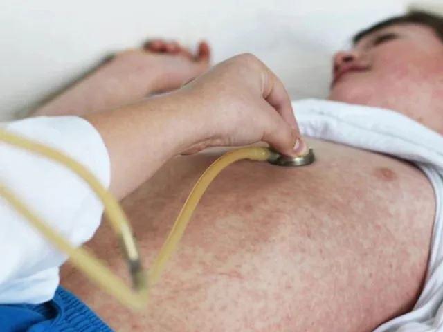 هشدار نسبت به افزایش موارد ابتلا به سرخک در ایالت استرالیای غربی