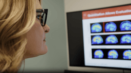 نقطه عطف در درمان آلزایمر؛ استفاده از داروی جدید "کیسونلا" در استرالیا تایید شد