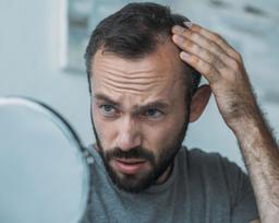 سلول‌های بنیادی، طاسی را درمان می‌کند؟