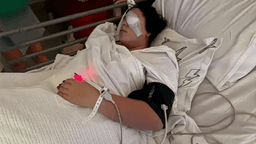 آسیب جدی یکی از چشمان دختر ۱۲ ساله بر اثر حمله کلاغ مهاجم در ایالت استرالیای غربی