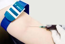 تشخیص آلزایمر با آزمایش خون