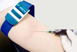 تشخیص آلزایمر با آزمایش خون