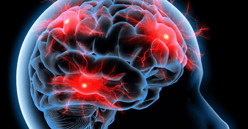 افراد عاطفی ساختار مغزی متفاوتی دارند