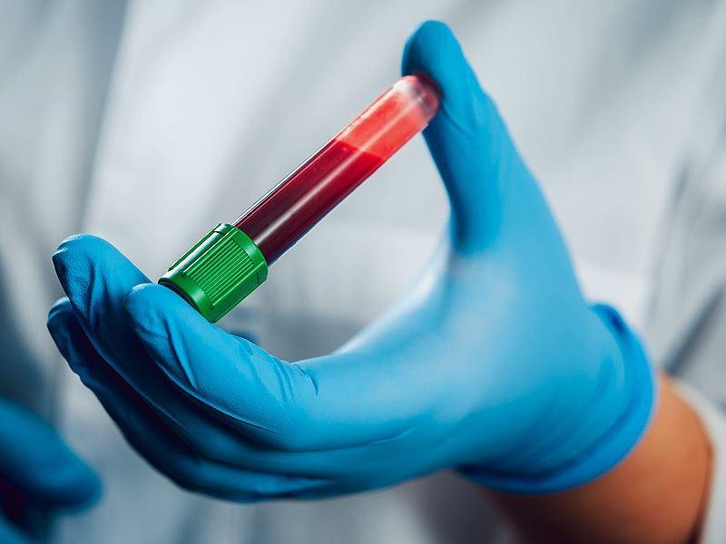   کشف بسیار مهم در رابطه با بیماری "ام‌اس" با همکاری دانشگاه مک کواری استرالیا