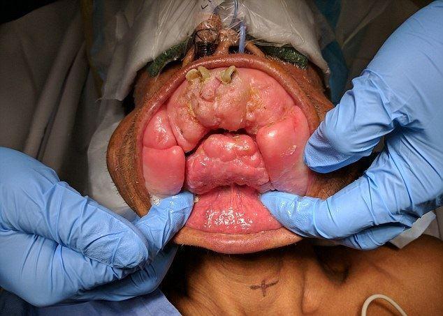 جراحان استرالیا مرد وحشتناک کامبوجی را با موفقیت عمل کردند
