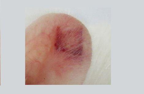 محققان استرالیا..توسعه یک نانوپچ کوچک برای درمان فلج اطفال