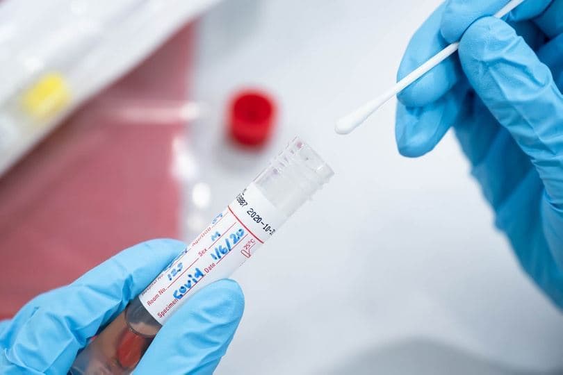 مثبت شدن جواب تست کووید یک زن بعد از ترک قرنطینه