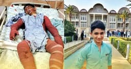 فوت نوجوان فداکار ایرانی بر اثر سوختگی شدید