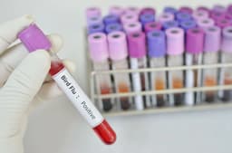 گزارش اولین نمونه ابتلای انسان به آنفولانزای پرندگان در چین