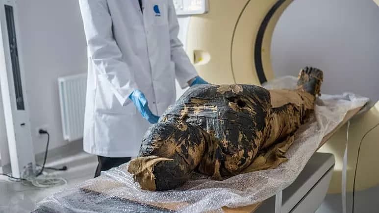 سرطان؛ دلیل مرگ نخستین مومیایی باردار مصر باستان