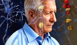 حسگرهای جدید آلمانی‌ها برای تشخیص آلزایمر 17 سال قبل از شروع