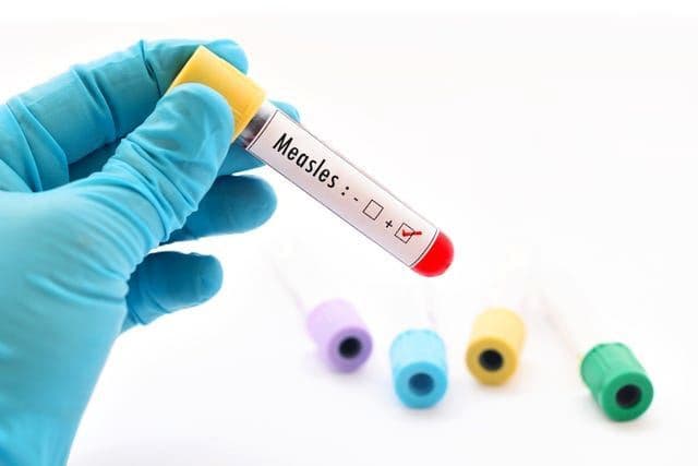هشدار به ساکنان سیدنی در خصوص احتمال ابتلا به بیماری سرخک