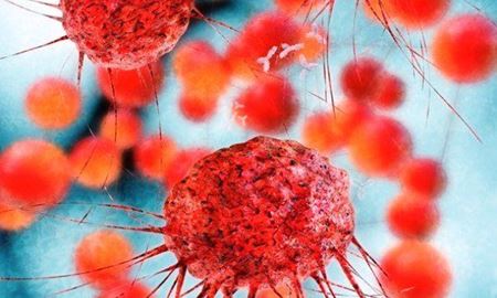 درمان سرطان خون توسط دانشمندان استرالیایی کشف شد