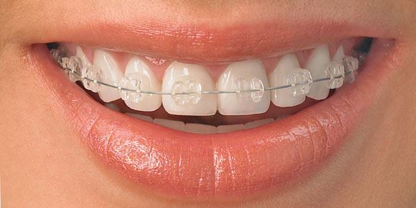 موضوع دندانپزشکی: پاسخ به سوالات ...مشکلات مکیدن شست توسط کودکان /درخصوص ارتودنسی دندان/ ..همراه با دکتر مهرداد ابولقاسمی