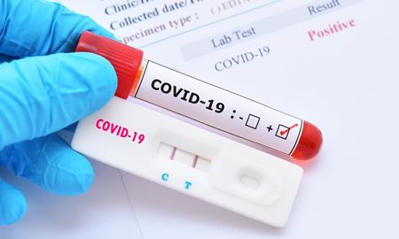 شناسایی 2 بیمار مبتلا به کووید-19 در سیدنی