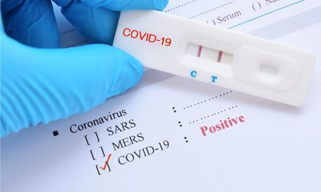 شناسایی 12 بیمار جدید مبتلا به کووید-19 در نیوساوت ولز