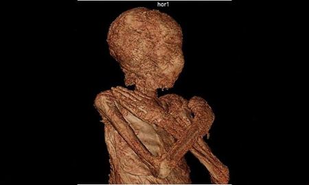 راز سالم ماندن جنین زن مومیایی 2 هزار ساله