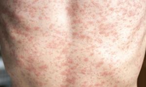 media.news.imagealternatetextformat.details